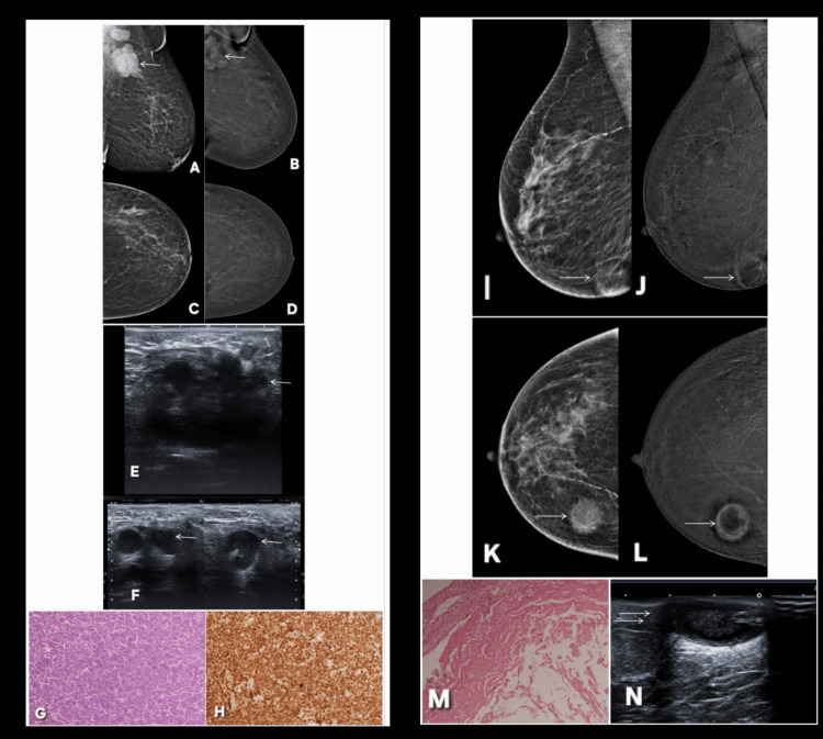 Figure 24