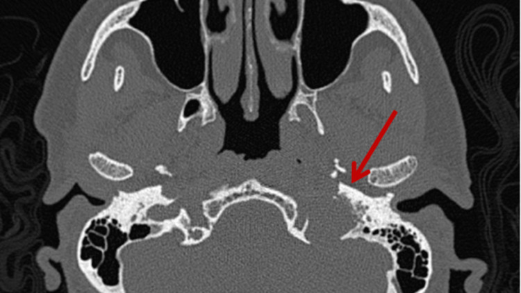 Figure 2