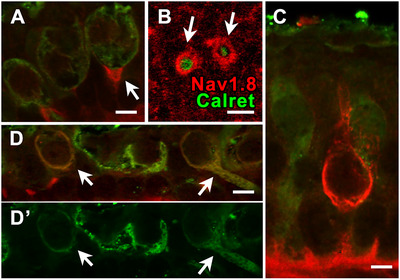 Figure 14