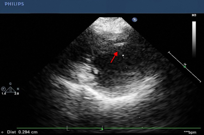 Figure 9