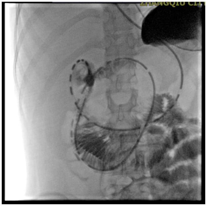 Figure 6