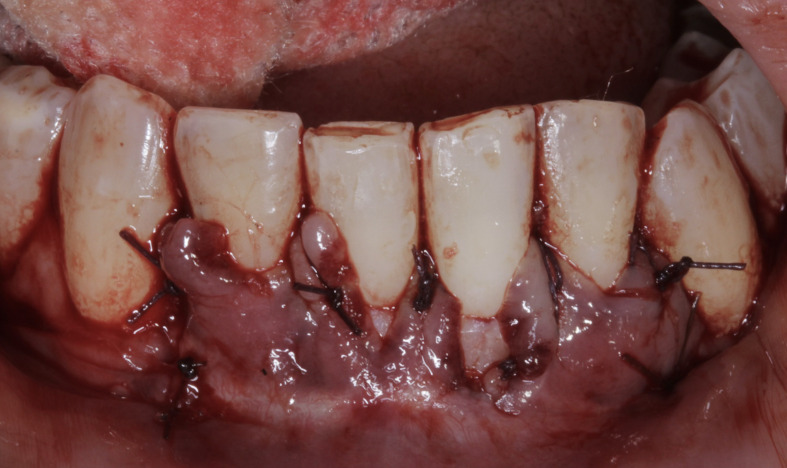 Figure 10