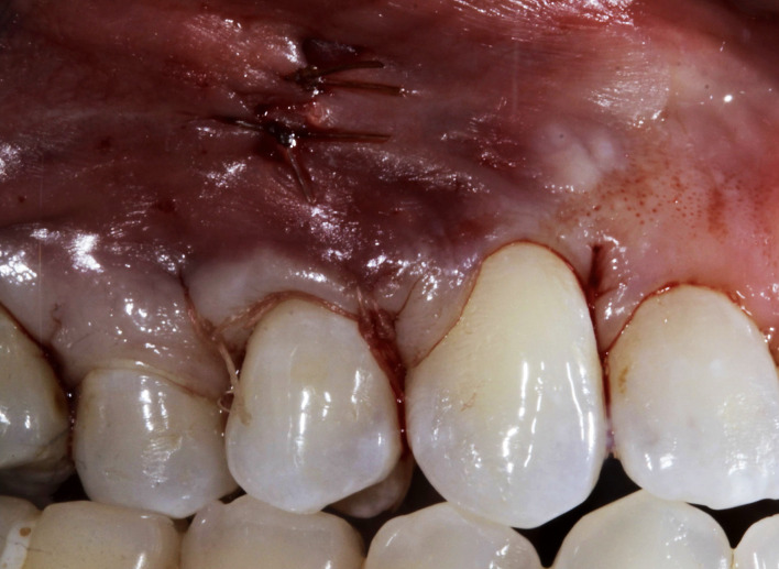 Figure 15