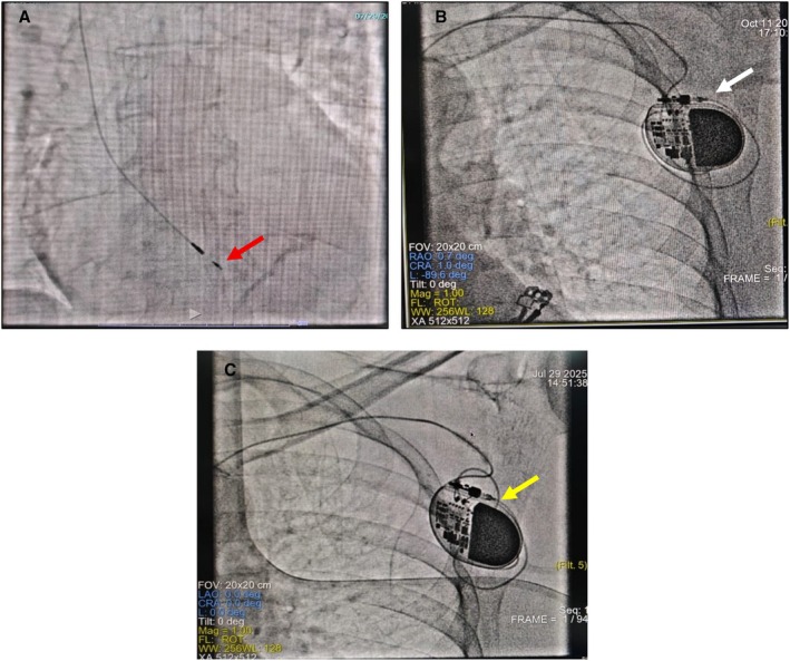 Figure 4