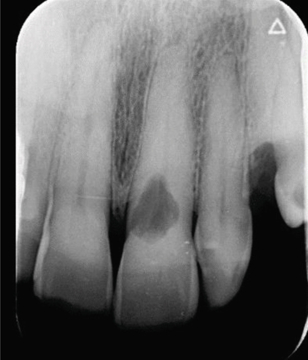 Figure 12