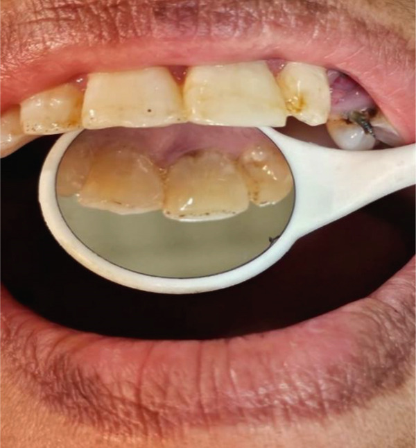 Figure 13