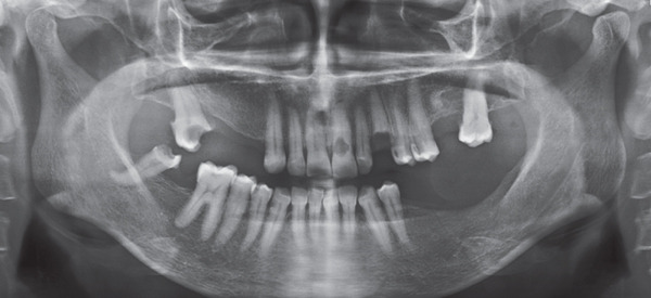 Figure 14