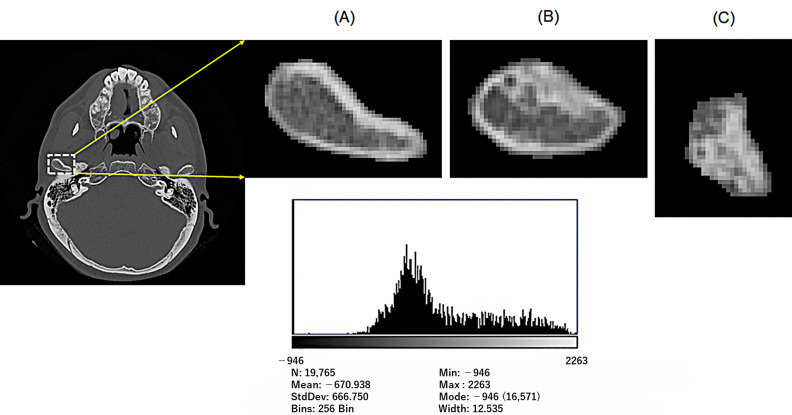 Figure 2