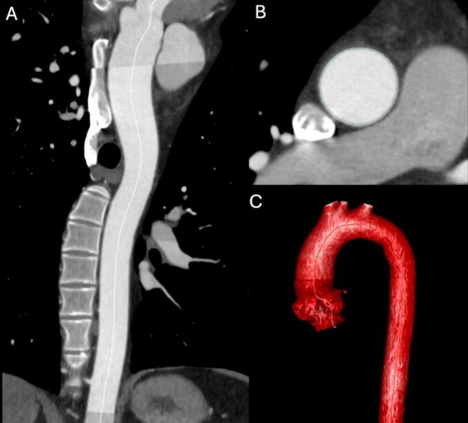 Figure 2