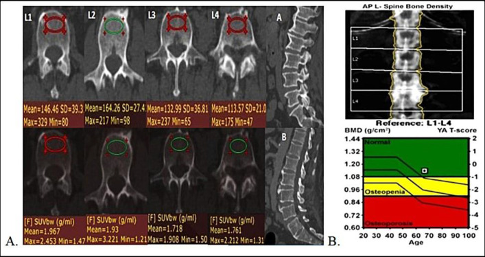 Figure 15
