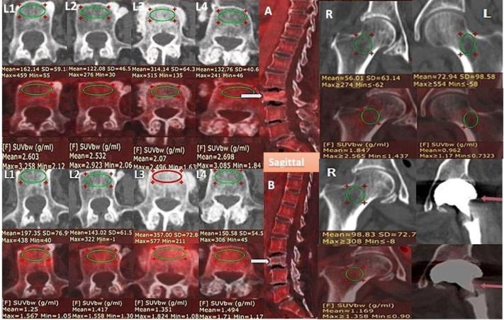 Figure 16