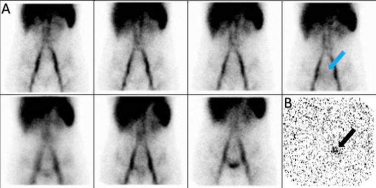 Figure 11