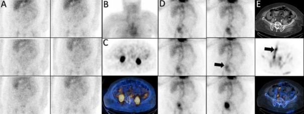 Figure 17