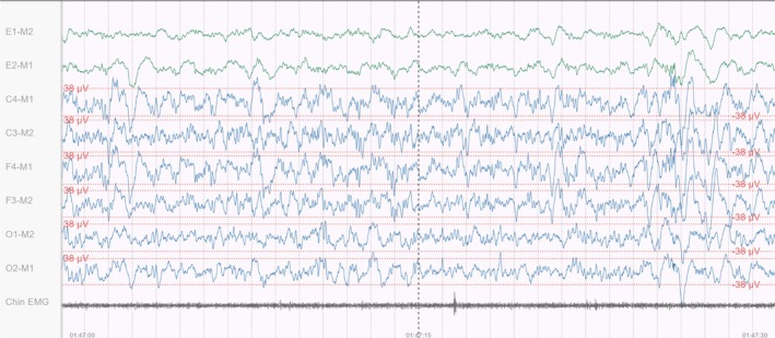 Figure 9