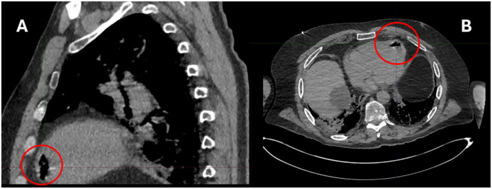 Figure 6