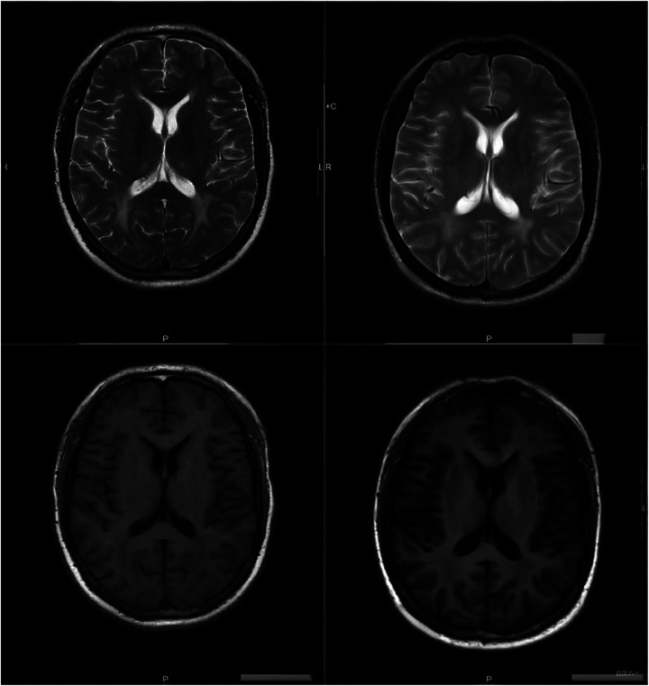 Figure 2