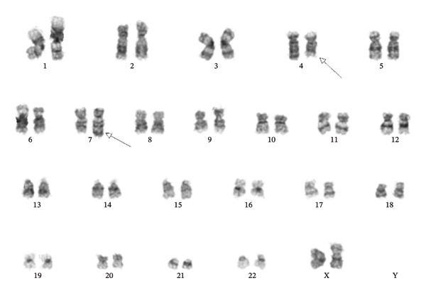 FIGURE 3