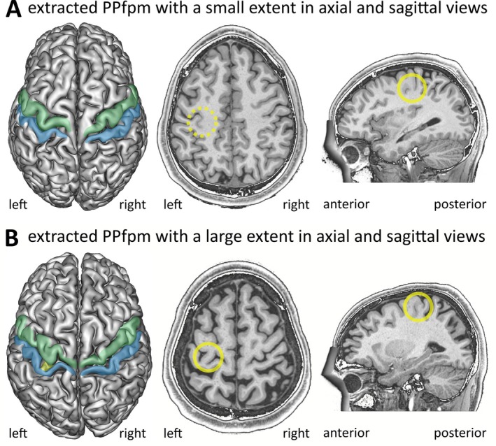 FIGURE 11