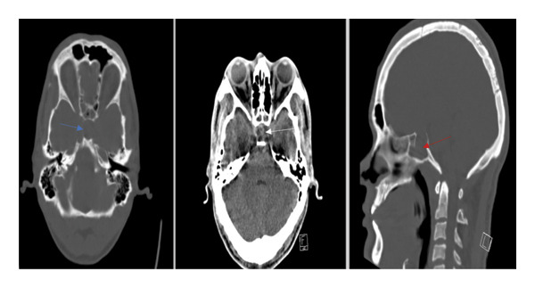 Figure 1