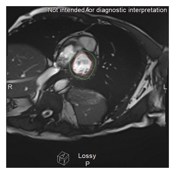 FIGURE 2