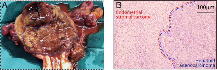 Figure 2