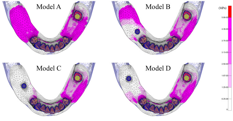 Figure 14