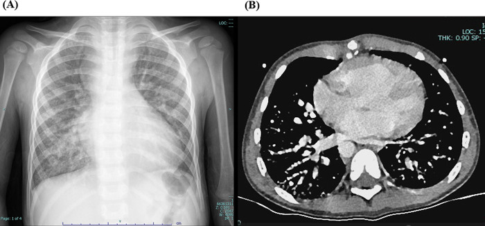 Figure 1