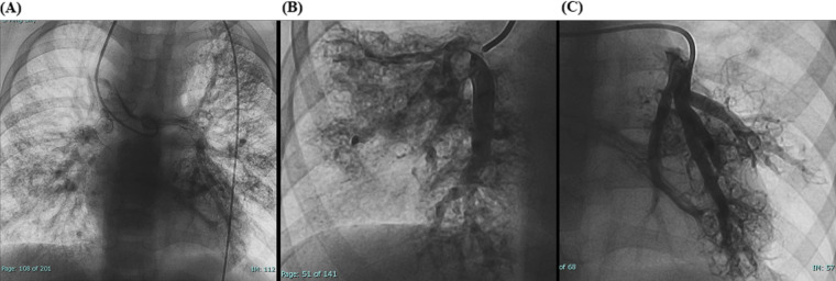 Figure 2