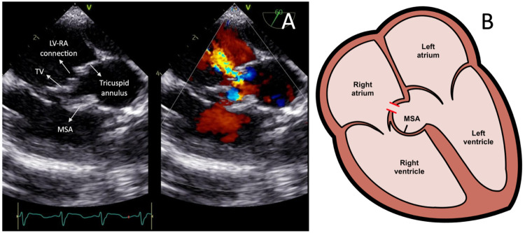 Figure 2