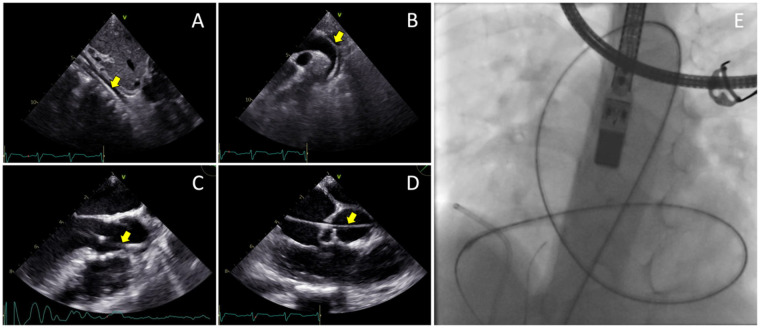 Figure 3