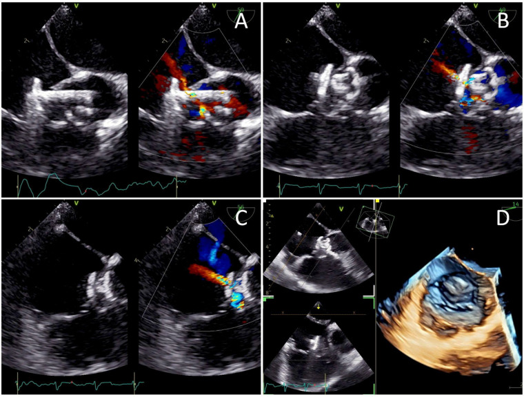 Figure 4
