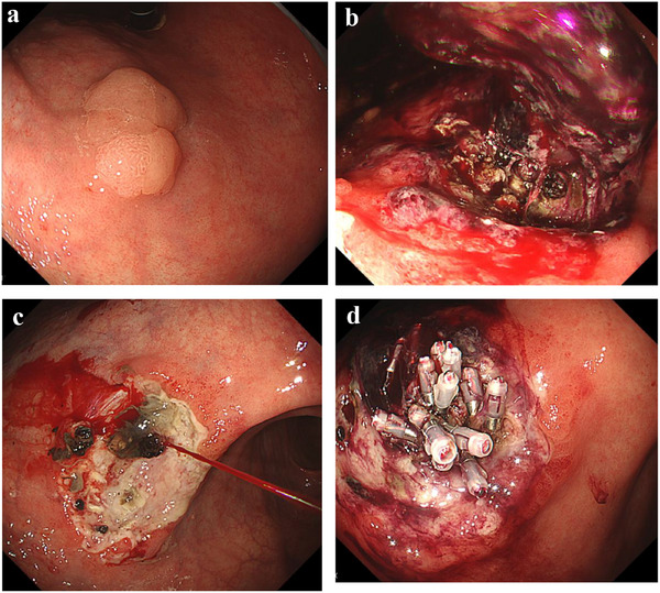 FIGURE 3