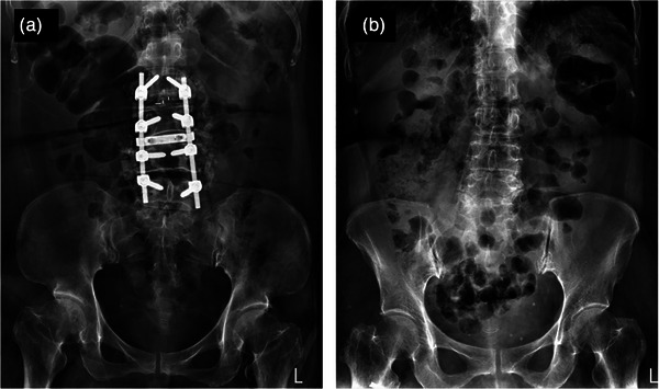 FIGURE 4