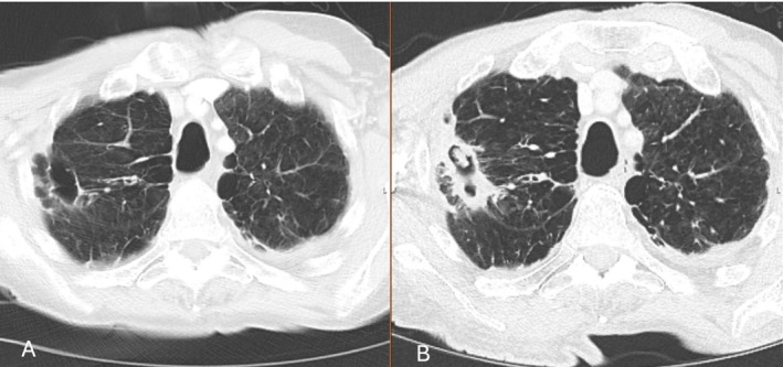 FIGURE 1