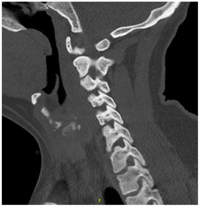 Figure 2