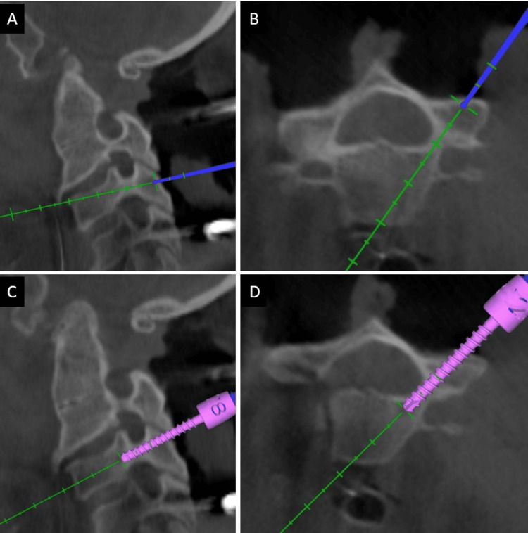 Figure 4