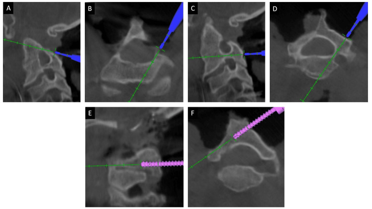 Figure 5