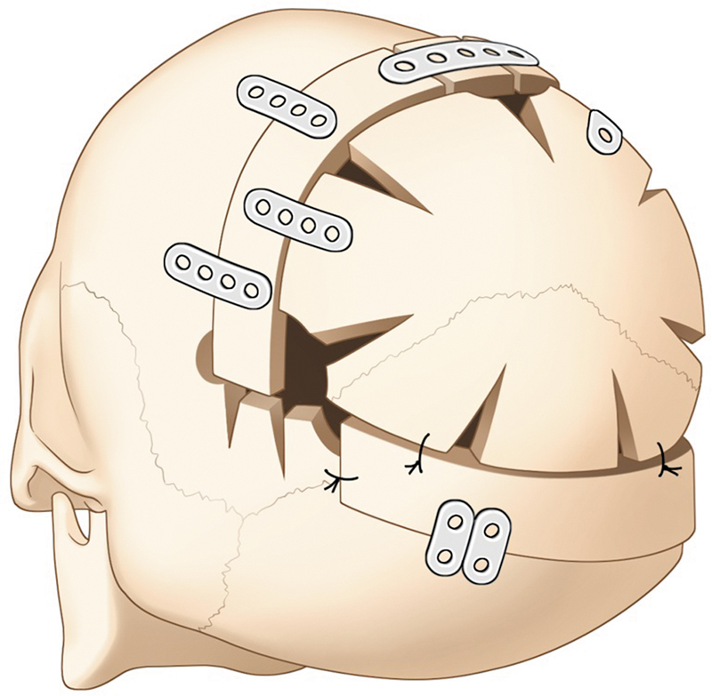 Fig. 9