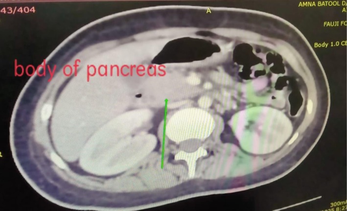 Figure 6