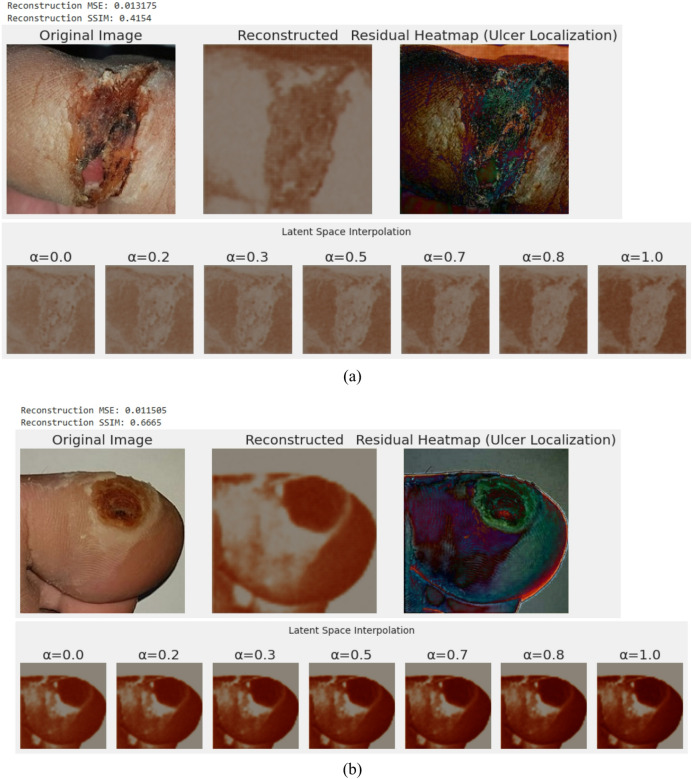 Figure 22