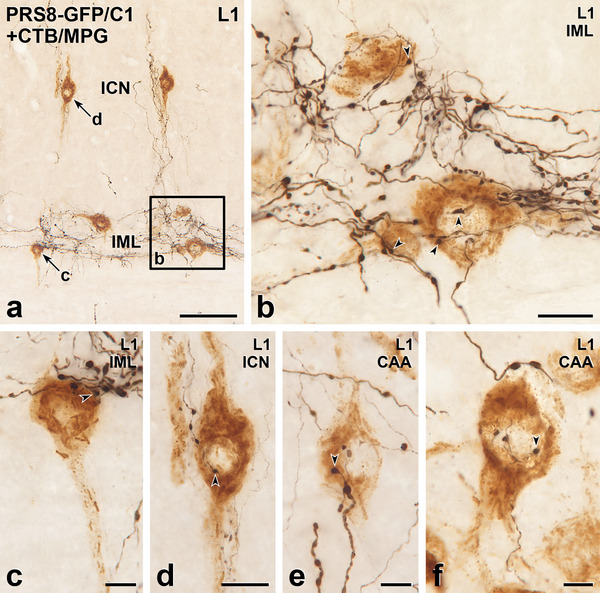 Figure 13