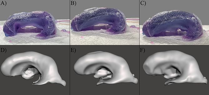 Figure 14