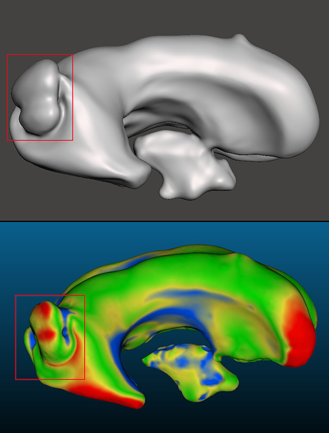 Figure 15