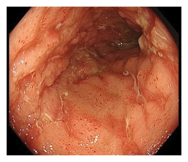 Figure 7