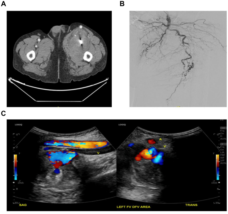 Figure 4