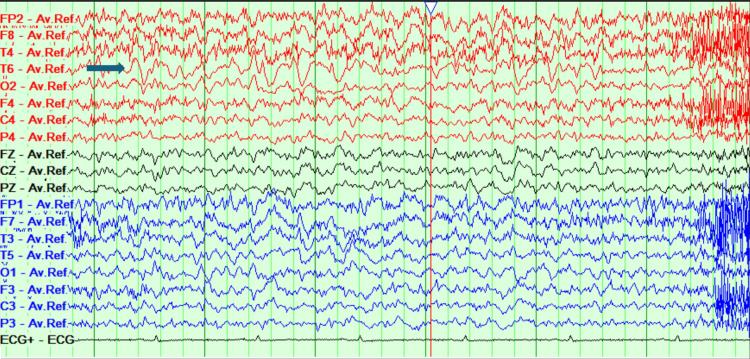 Figure 7