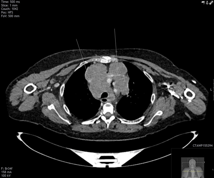 Figure 13