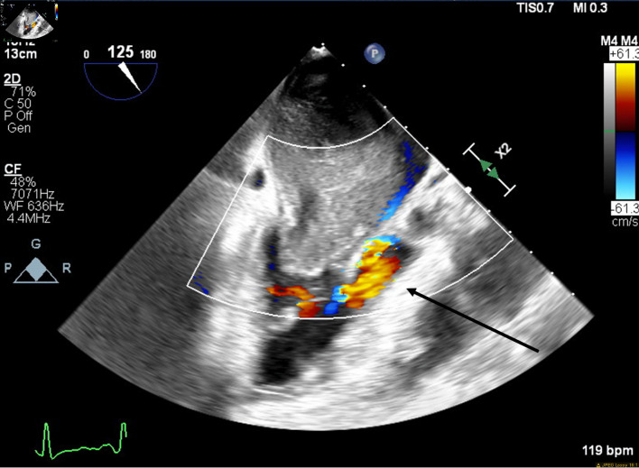 Figure 5