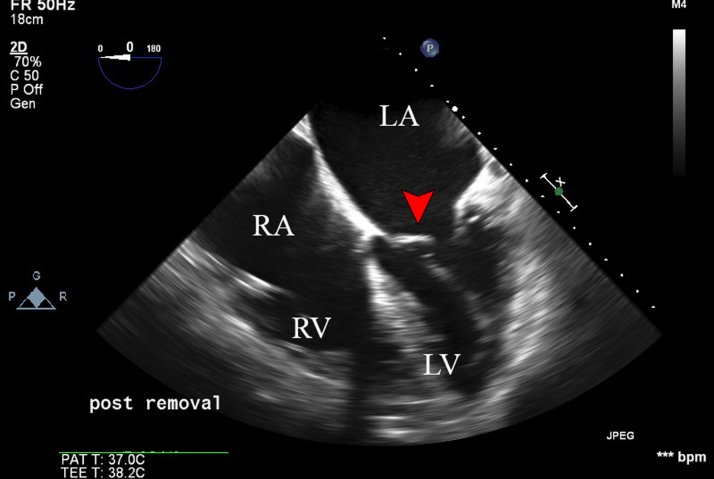 Figure 5
