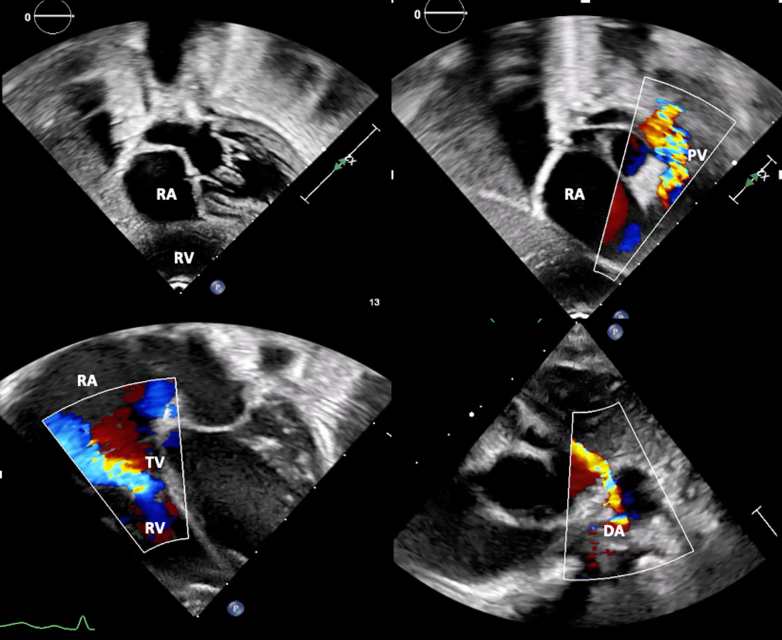 Figure 4